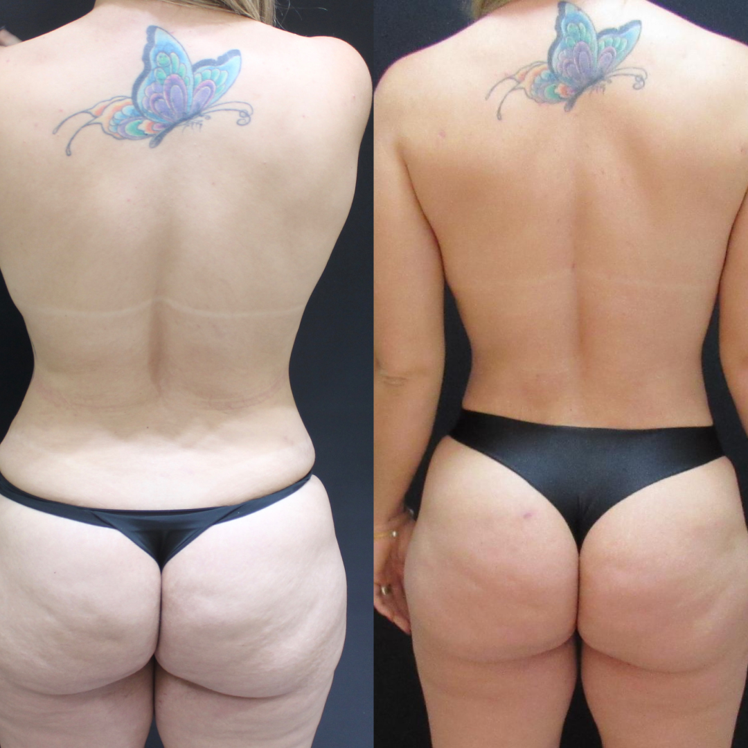Antes e depois — resultado real
